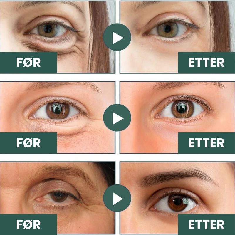 Trelii Micro Glow Patches