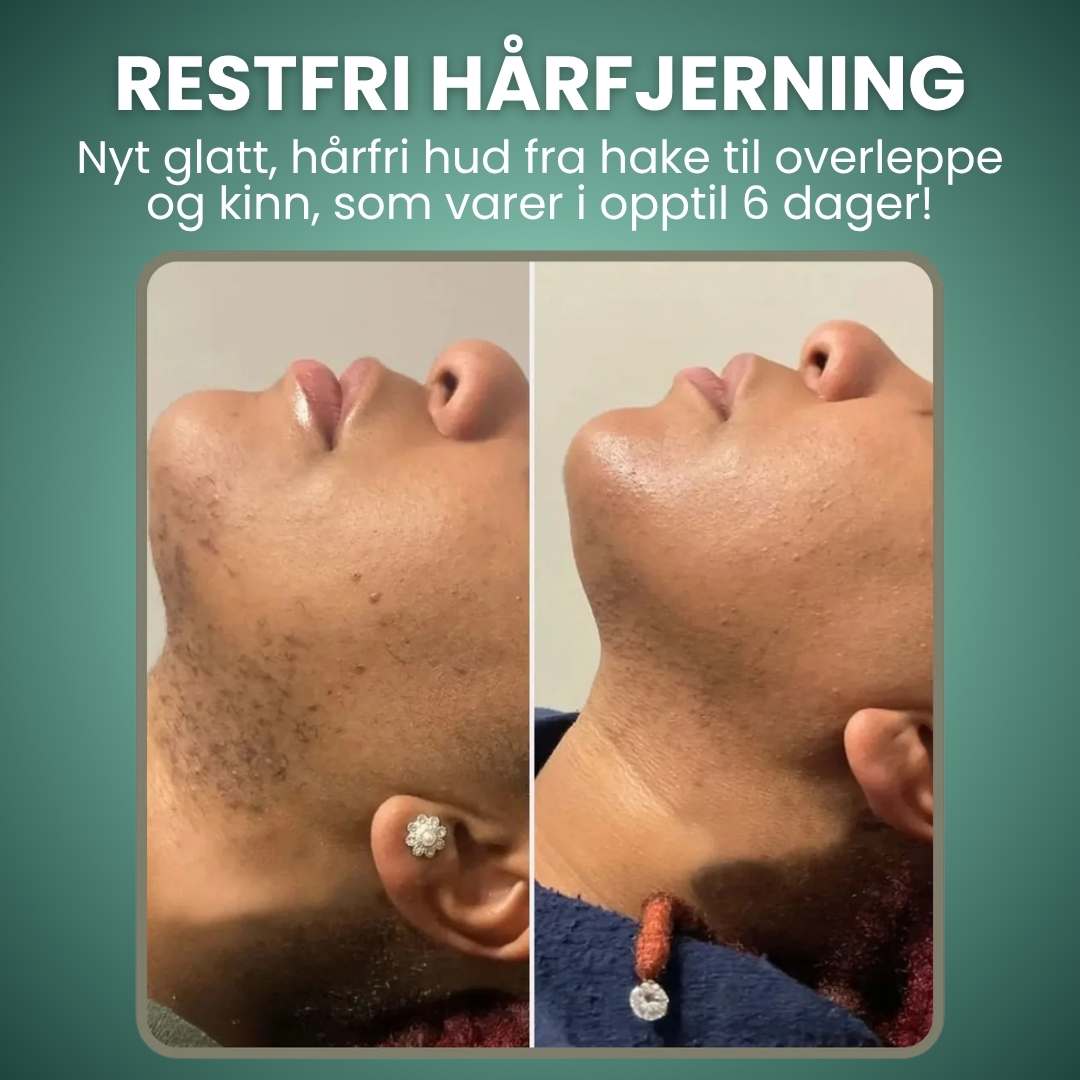 Trelii Hårfjerningskrem-Ansikt