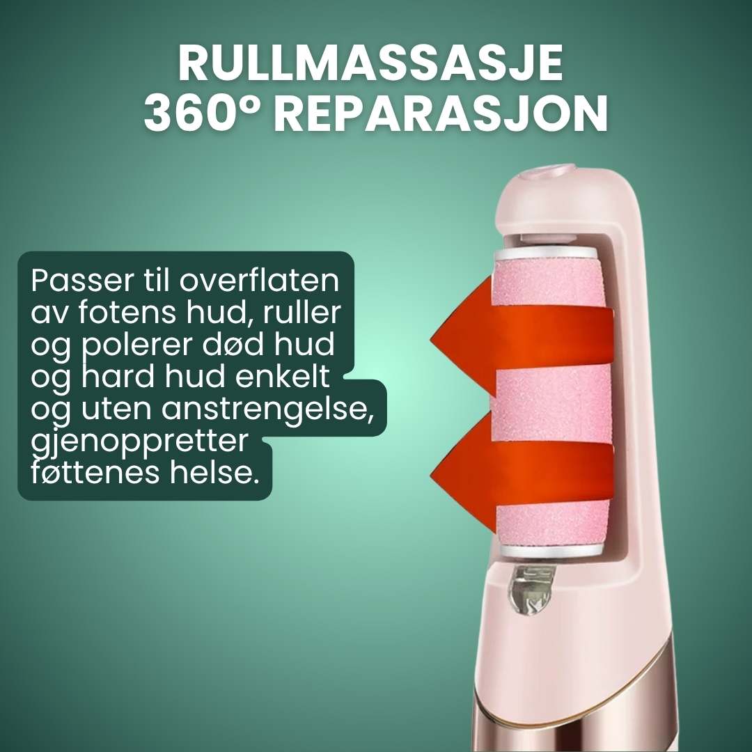 Trelii Förhårdnad-sborttagare