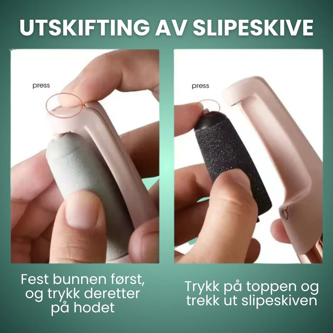 Trelii Förhårdnad-sborttagare