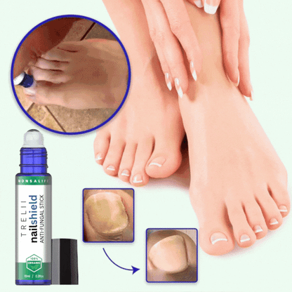 Trelii NailShield Anti-Fungal Stick