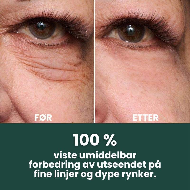 Trelii Foundation | Synlig glatter ut rynker på bare 2 minutter – strålende hud som varer hele dagen!