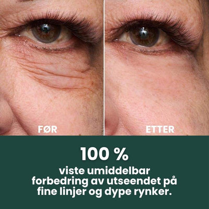 Trelii Foundation | Synlig glatter ut rynker på bare 2 minutter – strålende hud som varer hele dagen!