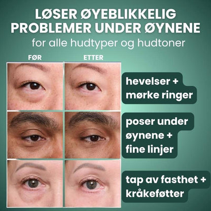 Trelii Foundation | Synlig glatter ut rynker på bare 2 minutter – strålende hud som varer hele dagen!