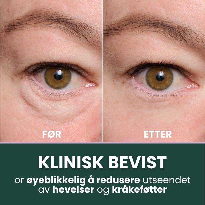 Trelii Foundation | Synlig glatter ut rynker på bare 2 minutter – strålende hud som varer hele dagen!