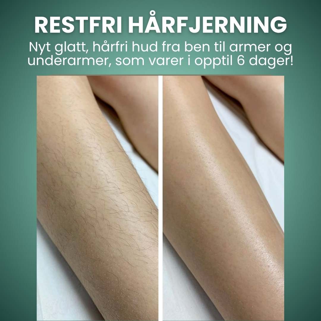 Trelii Kroppshårfjerningskre